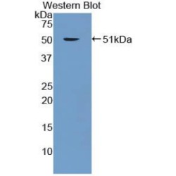 Enolase, Non Neuronal (NNE) Antibody