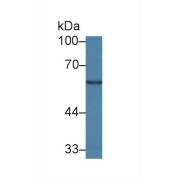 Western blot analysis of Human Lung lysate, using Human GALC Antibody (2 µg/ml) and HRP-conjugated Goat Anti-Rabbit antibody (<a href="https://www.abbexa.com/index.php?route=product/search&amp;search=abx400043" target="_blank">abx400043</a>, 0.2 µg/ml).