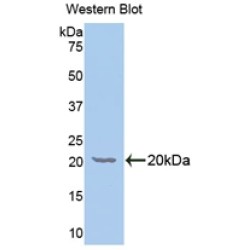 Galactosylceramidase (GALC) Antibody