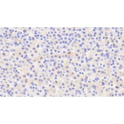 Iduronate-2-Sulfatase (IDS) Antibody