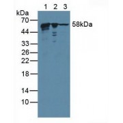 Western blot analysis of (1) Human HepG2 Cells, (2) Human 293T Cells and (3) Human Raji Cells.