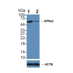 Karyopherin Alpha 2 (KPNa2) Antibody