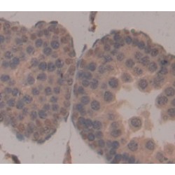 Karyopherin Alpha 2 (KPNa2) Antibody