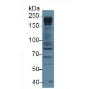 Western blot analysis of Human Jurkat cell lysate, using Human NUP205 Antibody (3 µg/ml) and HRP-conjugated Goat Anti-Rabbit antibody (<a href="https://www.abbexa.com/index.php?route=product/search&amp;search=abx400043" target="_blank">abx400043</a>, 0.2 µg/ml).