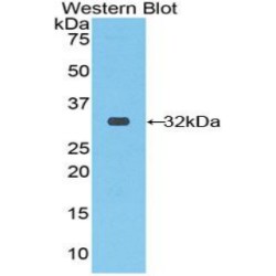 Ribonuclease Inhibitor (RI) Antibody
