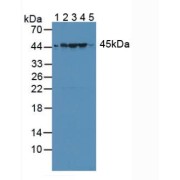 Western blot analysis of (1) Rat Serum, (2) Rat Liver Tissue, (3) Rat Heart Tissue, (4) Rat Brain Tissue and (5) Human Jurkat Tissue.