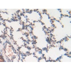 Ribonuclease Inhibitor (RI) Antibody