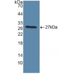 Toll Like Receptor 2 (TLR2) Antibody