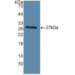 Toll Like Receptor 2 (TLR2) Antibody