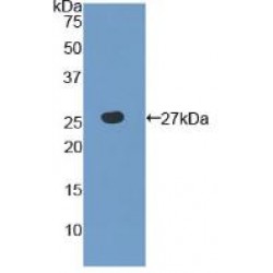 Toll Like Receptor 6 (TLR6) Antibody