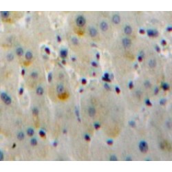 Toll Like Receptor 6 (TLR6) Antibody