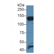 Western blot analysis of Mouse Liver lysate, using Mouse AAP Antibody (1 µg/ml) and HRP-conjugated Goat Anti-Rabbit antibody (<a href="https://www.abbexa.com/index.php?route=product/search&amp;search=abx400043" target="_blank">abx400043</a>, 0.2 µg/ml).