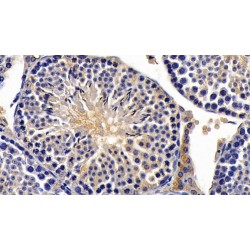 Muellerian-Inhibiting Factor (AMH) Antibody