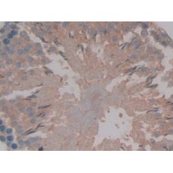 Muellerian-Inhibiting Factor (AMH) Antibody