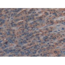 Muellerian-Inhibiting Factor (AMH) Antibody