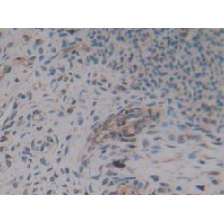 Muellerian-Inhibiting Factor (AMH) Antibody