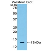 Western blot analysis of the recombinant protein.