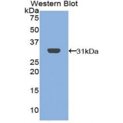 B-Cell Linker Protein (BLNK) Antibody