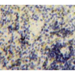 B-Cell Linker Protein (BLNK) Antibody