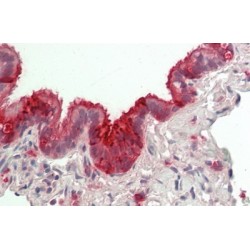 Uteroglobin (SCGB1A1) Antibody