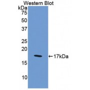 Western blot analysis of recombinant Human F8.