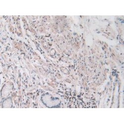 Cofilin 1, Non Muscle (CFL1) Antibody