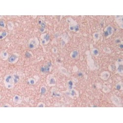 Cytochrome P450 1A2 (CYP1A2) Antibody