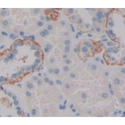 Cytochrome P450 1B1 (CYP1B1) Antibody