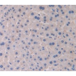 Cytochrome P450 2E1 (CYP2E1) Antibody