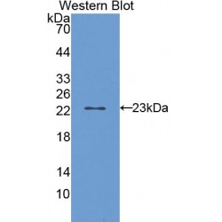 Cytochrome P450 2E1 (CYP2E1) Antibody