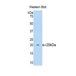 Cytochrome P450 3A7 (CYP3A7) Antibody