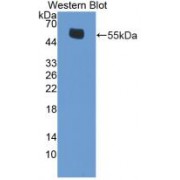 Western blot analysis of recombinant Mouse ERb.