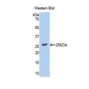 Western blot analysis of the recombinant protein.