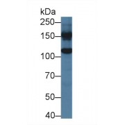 Western blot analysis of Mouse Liver lysate, using Human GLDC Antibody (2 µg/ml) and HRP-conjugated Goat Anti-Rabbit antibody (<a href="https://www.abbexa.com/index.php?route=product/search&amp;search=abx400043" target="_blank">abx400043</a>, 0.2 µg/ml).