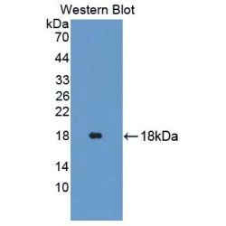 Glycine Dehydrogenase (GLDC) Antibody