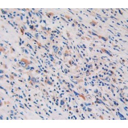 Glycine Dehydrogenase (GLDC) Antibody