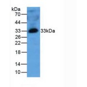 Western blot analysis of Human Plasma Tissue.