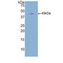 Mannose Binding Lectin (MBL) Antibody