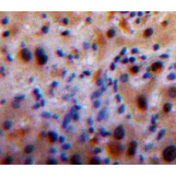 Mannose Binding Lectin (MBL) Antibody