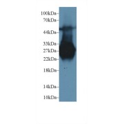 Western blot analysis of Rat Liver lysate, using Rat MBL Antibody (1 µg/ml) and HRP-conjugated Goat Anti-Rabbit antibody (<a href="https://www.abbexa.com/index.php?route=product/search&amp;search=abx400043" target="_blank">abx400043</a>, 0.2 µg/ml).
