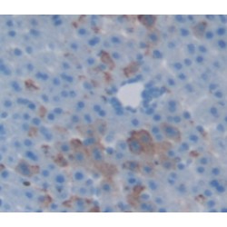 Mannose Binding Lectin (MBL) Antibody