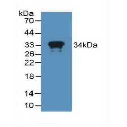 Interferon-Induced GTP-Binding Protein Mx1 (MX1) Antibody