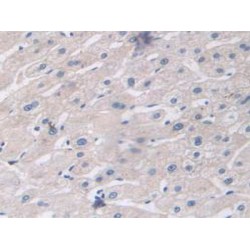 Interferon-Induced GTP-Binding Protein Mx1 (MX1) Antibody