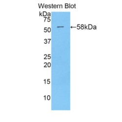Interferon-Induced GTP-Binding Protein Mx1 (MX1) Antibody