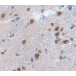 Interferon-Induced GTP-Binding Protein Mx1 (MX1) Antibody