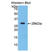 Western blot analysis of the recombinant protein.