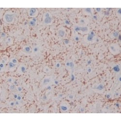 Neuronal Pentraxin I (NPTX1) Antibody