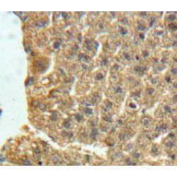 Neuronal Pentraxin I (NPTX1) Antibody