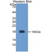 Western blot analysis of recombinant Rat AGRP.