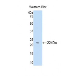 Alpha-1-B Glycoprotein (A1BG) Antibody